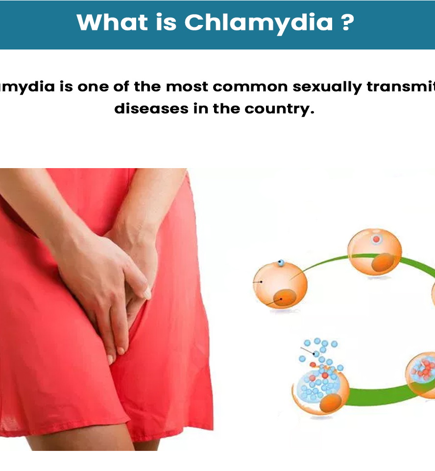 what is chlamydia